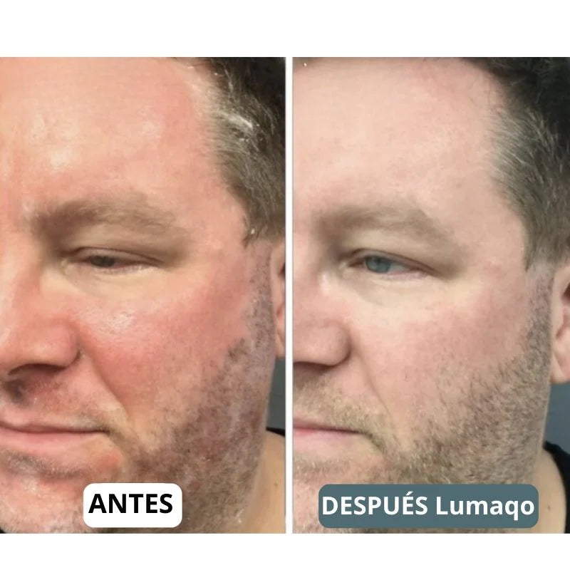 SensiCalma® Duo+ ⎜ Barba y cuero cabelludo calmados